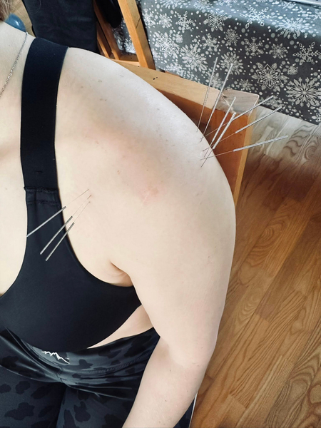 Zdjęcie na okładce dla PHYSIOEQUINA mobilna fizjoterapia Klaudia Matuszak